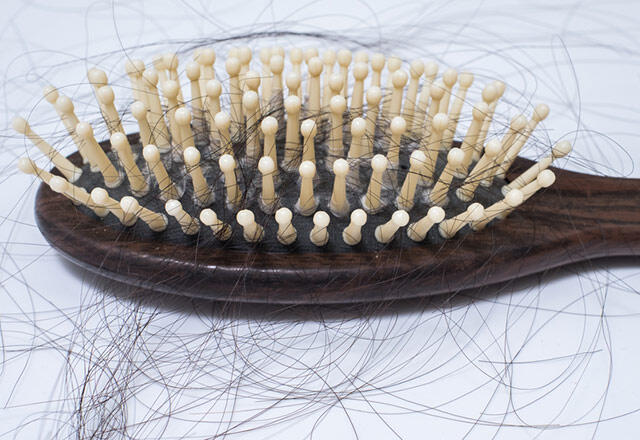 Kokių ligų požymis yra plaukų slinkimas?