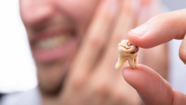 Ποια όργανα του σώματος μπορεί να βλάψει ένα σάπιο δόντι; - Τροφές που κάνουν καλό στην τερηδόνα