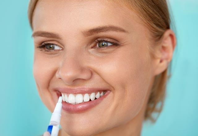 Mikä on hampaiden valkaisukynä, mitä se tekee?