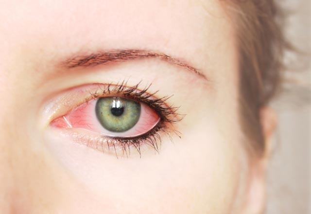 Welche Kräuter sind gut für trockene Augen?