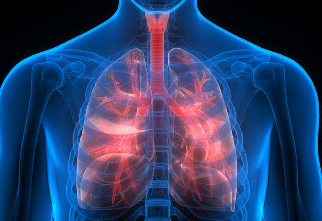 Symptome einer Lungenperforation