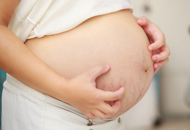 Möglichkeiten, Schwangerschaftsjucken loszuwerden