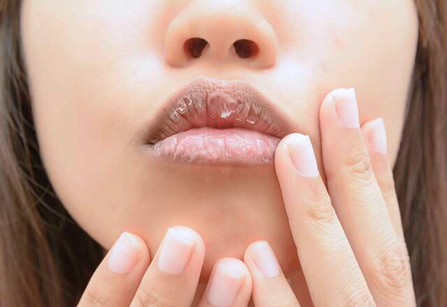 Hvad forårsager tørre læber, hvordan passerer det?