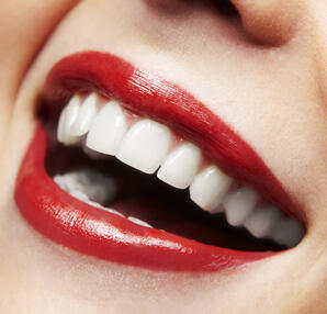 10 grunner til å starte tannreguleringsbehandling