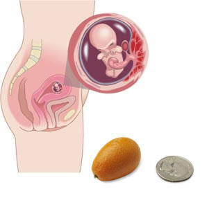 10. Schwangerschaftswoche