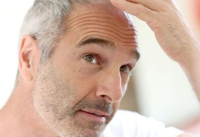 Pourquoi les cheveux blanchissent-ils ? Quelles sont les causes du blanchiment des cheveux ?