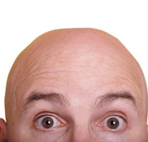 Kaip plaukų persodinimas atliekamas naudojant FUE valdymą?