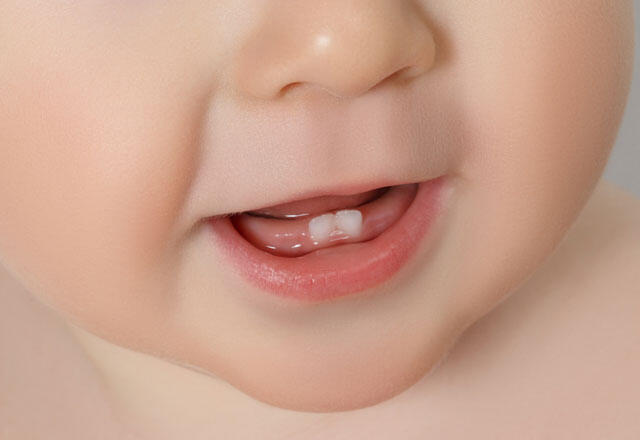Dantų dygimo simptomai kūdikiams