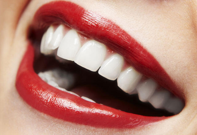 Aandacht voor degenen die tanden witter willen maken