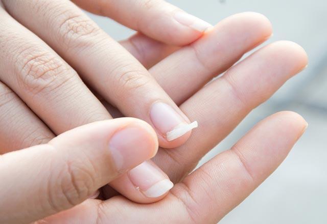 Ce cauzează ruperea unghiilor, cum poate fi prevenită?