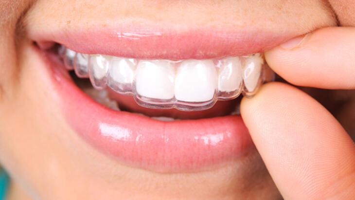 Co je ortodoncie, na co se dívá? Jaká onemocnění léčí ortodontista (ortodontista)?