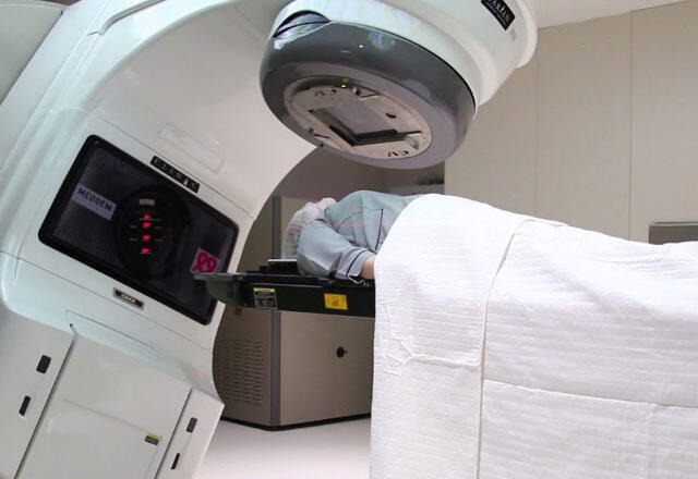 Aké sú vedľajšie účinky rádioterapie (liečba ožarovaním)?