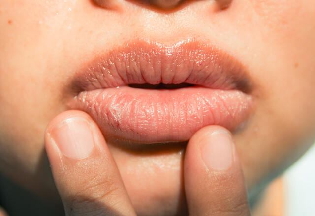 Was verursacht Lippenzucken, wie geht es?