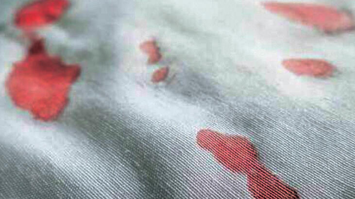 Cum să elimini petele de sânge, la ce este bun? Ce ar trebui făcut pentru a îndepărta pata de sânge uscat?